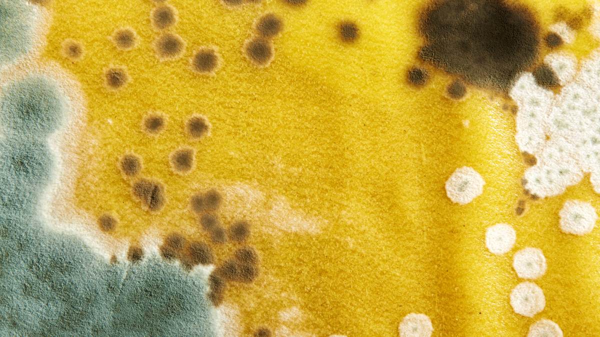 Neuropsychiatric Clinical Presentation of Mold Illness
