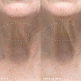 Necks-Level Smooth™