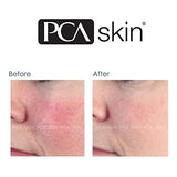 Anti-Redness