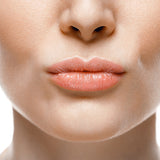 Hyaluronic Acid