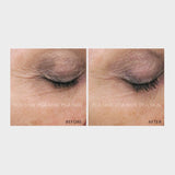 Rejuvenating Serum